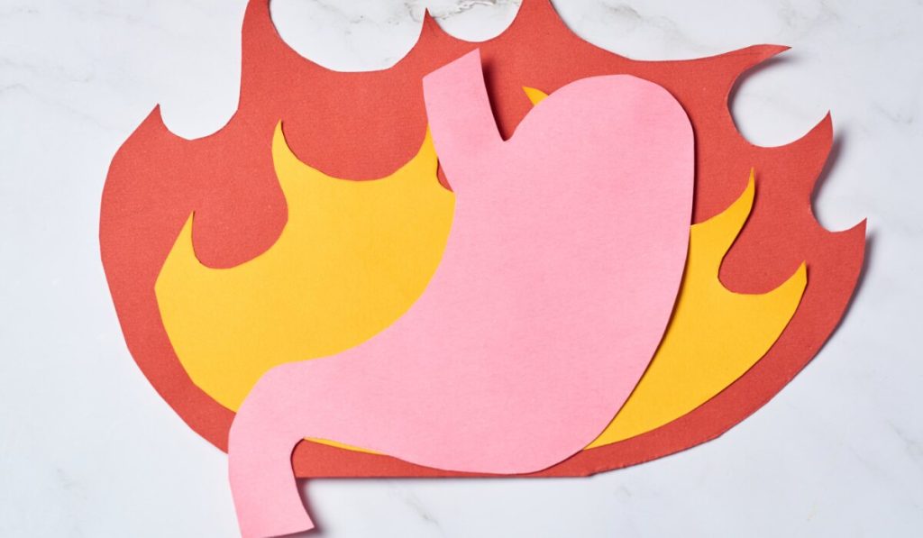 How to Stop Stomach Burning Immediately